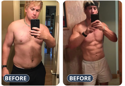 Lymphatic Support Drops³